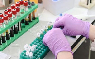 Кръвен тест разпознава предракови лезии в дебелото черво