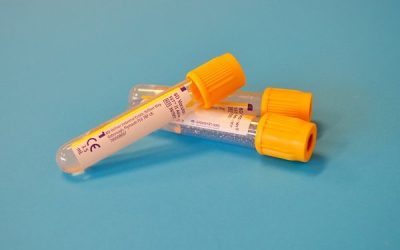 Безплатен скрининг за хепатит В и С в два квартала на София